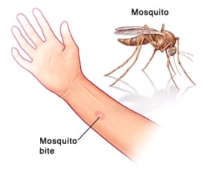 mosquito 3.jpg