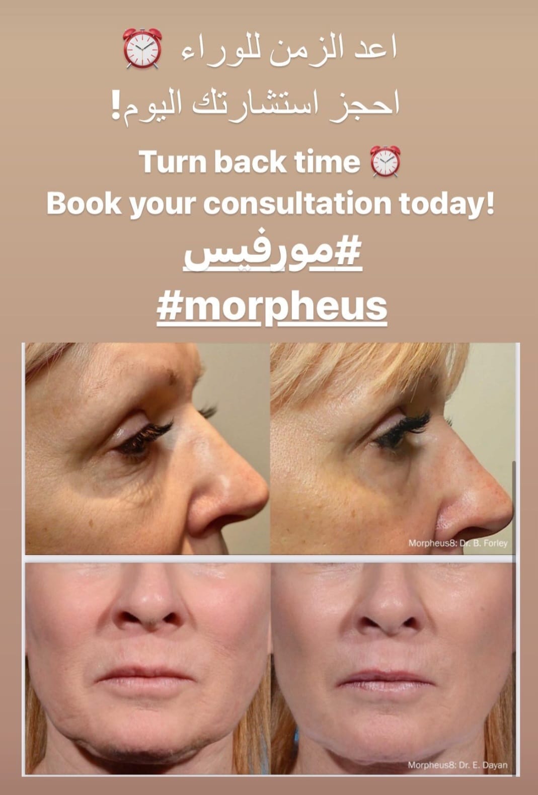 Book Your Morpheus8 Session in Skin Institute Clinic Abu Dhabi