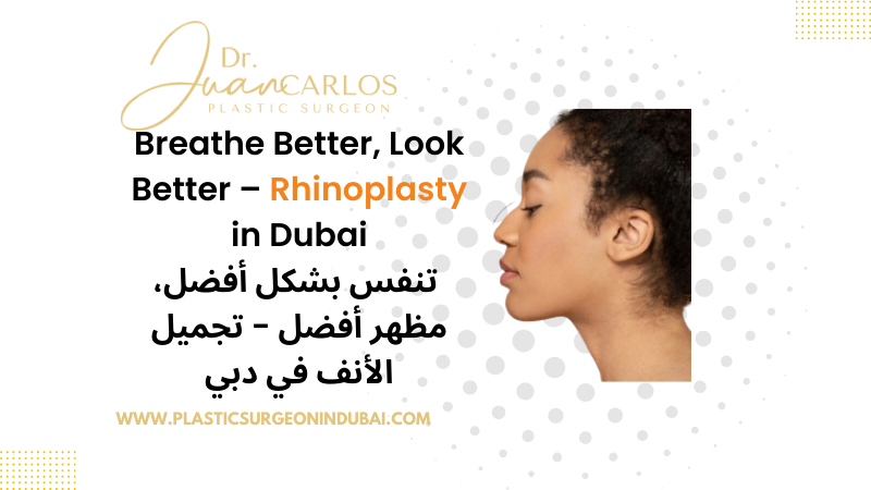 Rhinoplasty in Dubai (3)1750418467